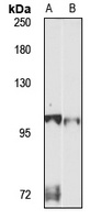AP1B1 Rabbit Polyclonal Antibody