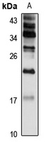 AP1S1 Rabbit Polyclonal Antibody