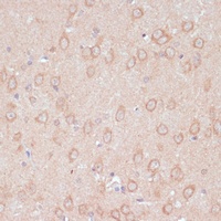 ARL4D Rabbit Polyclonal Antibody