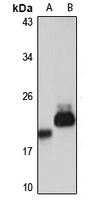 ARL8B Rabbit Polyclonal Antibody