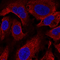 ARL8B Rabbit Polyclonal Antibody