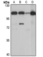 ASCC2 Rabbit Polyclonal Antibody