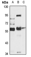 ASIC2 Rabbit Polyclonal Antibody