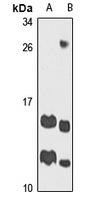 ATP5J Rabbit Polyclonal Antibody