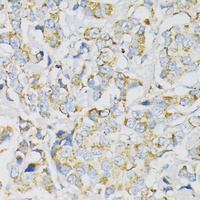 ATP5J Rabbit Polyclonal Antibody