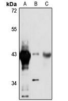 BXDC2 Rabbit Polyclonal Antibody