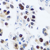 BXDC2 Rabbit Polyclonal Antibody