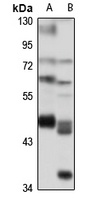 BZW1 Rabbit Polyclonal Antibody