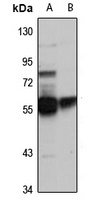 CACNB4 Rabbit Polyclonal Antibody