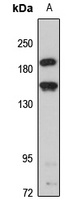 CADPS2 Rabbit Polyclonal Antibody