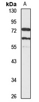 CaMKK alpha Rabbit Polyclonal Antibody