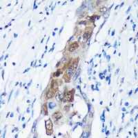CaMKK alpha Rabbit Polyclonal Antibody