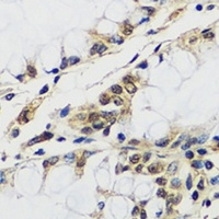 CASC5 Rabbit Polyclonal Antibody