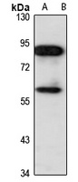 CBFA2T3 Rabbit Polyclonal Antibody