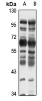 CBX2 Rabbit Polyclonal Antibody