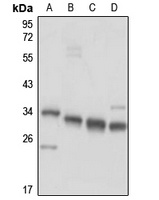 CCDC124 Rabbit Polyclonal Antibody