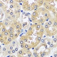 CCDC124 Rabbit Polyclonal Antibody