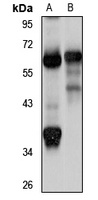 CCDC47 Rabbit Polyclonal Antibody