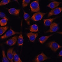CCDC47 Rabbit Polyclonal Antibody