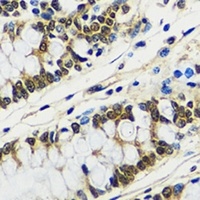 CCDC59 Antibody