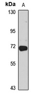 CCDC61 Rabbit Polyclonal Antibody