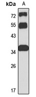CCDC92 Rabbit Polyclonal Antibody