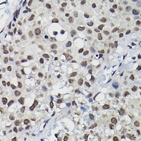 Cyclin K Rabbit Polyclonal Antibody