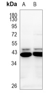 CCR9 Rabbit Polyclonal Antibody