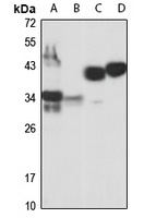 CD82 Rabbit Polyclonal Antibody