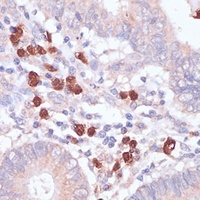 CD82 Rabbit Polyclonal Antibody