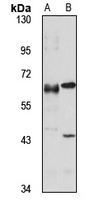 CDK5RAP1 Rabbit Polyclonal Antibody