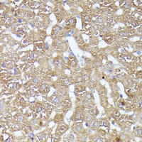 CDK5RAP1 Rabbit Polyclonal Antibody