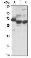 CDKN2AIP Rabbit Polyclonal Antibody
