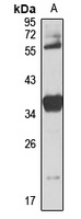 CENPK Rabbit Polyclonal Antibody