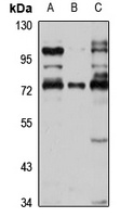 FHR-5 Rabbit Polyclonal Antibody