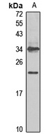 CGB3 Rabbit Polyclonal Antibody