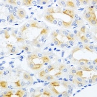 CGB3 Rabbit Polyclonal Antibody