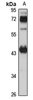 CHAD Rabbit Polyclonal Antibody