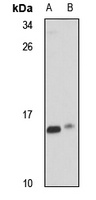 CHCHD1 Rabbit Polyclonal Antibody