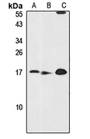 CHCHD4 Rabbit Polyclonal Antibody