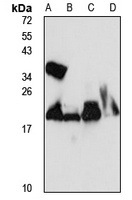 CHP1 Rabbit Polyclonal Antibody