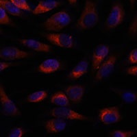 CHP1 Rabbit Polyclonal Antibody