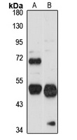 CHRDL1 Rabbit Polyclonal Antibody