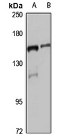 CLASP2 Rabbit Polyclonal Antibody