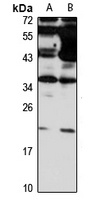 Claudin 14 Rabbit Polyclonal Antibody
