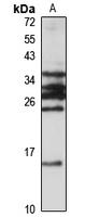 CCDC56 Rabbit Polyclonal Antibody