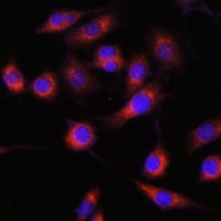 GPBP Antibody