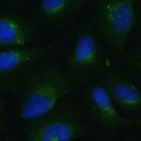 COPG2 Rabbit Polyclonal Antibody