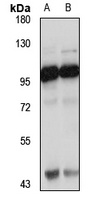 COPG2 Rabbit Polyclonal Antibody