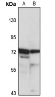 CPEB3 Rabbit Polyclonal Antibody